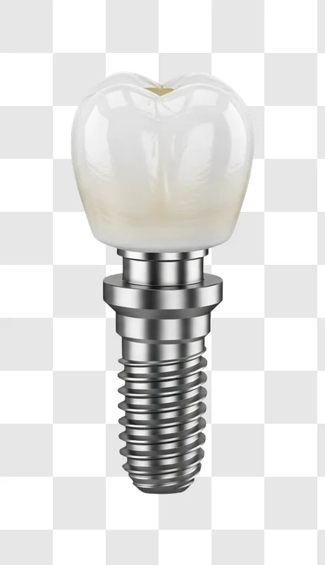 dental implant with ceramic tooth crown